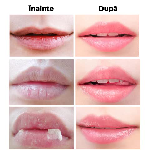 Balsamul de buze - HoneyLips