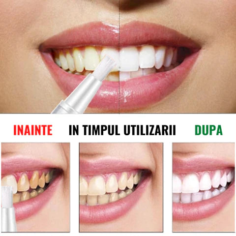 Stilou albire dinți EFERO Mr. White